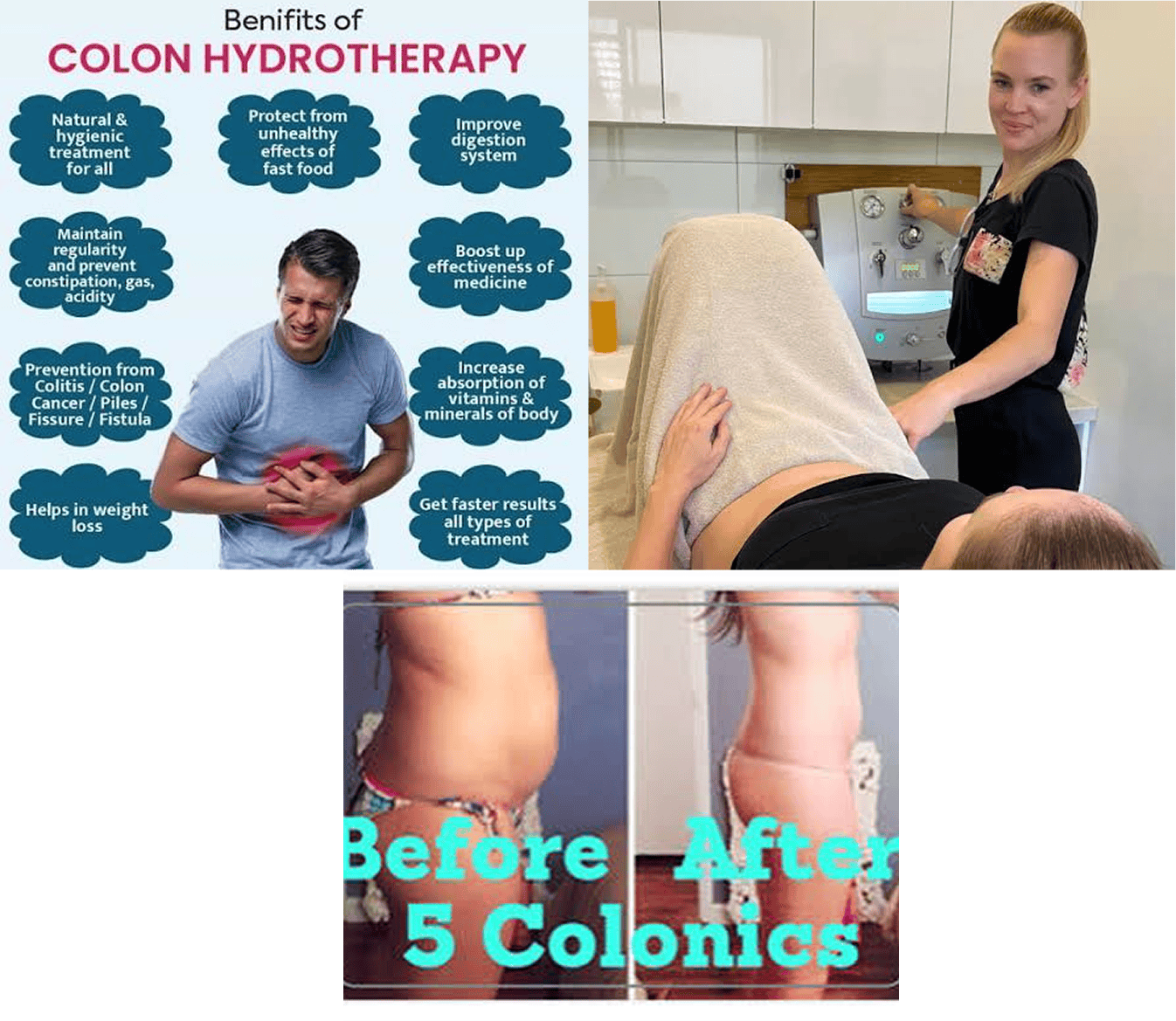 Colon hydrotherapy benefits and treatment demonstration.